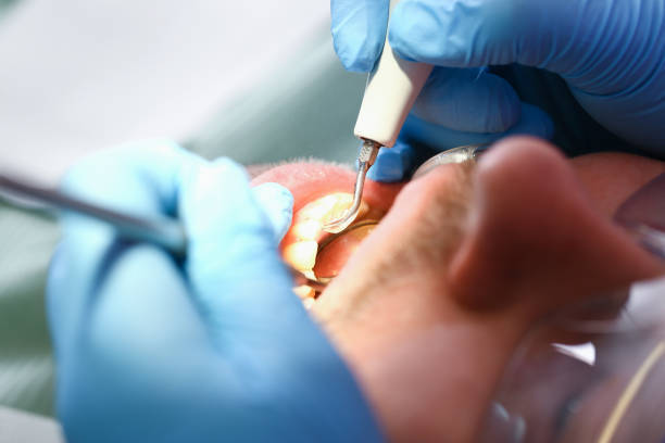 Best Emergency Denture Repair in Colwich, KS