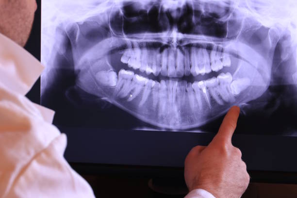 Best Knocked-Out Tooth (Avulsed Tooth) Treatment in Colwich, KS