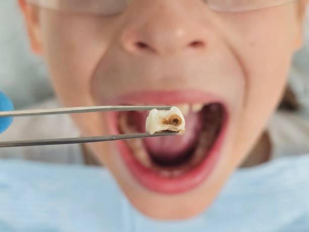 Best Walk-In Emergency Dental Services in Colwich, KS